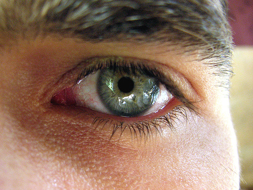Post image for Eyebrow Hair Replacement