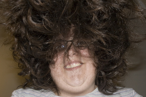 Post image for Are Multiple Hair Replacement Surgeries A Good Idea?