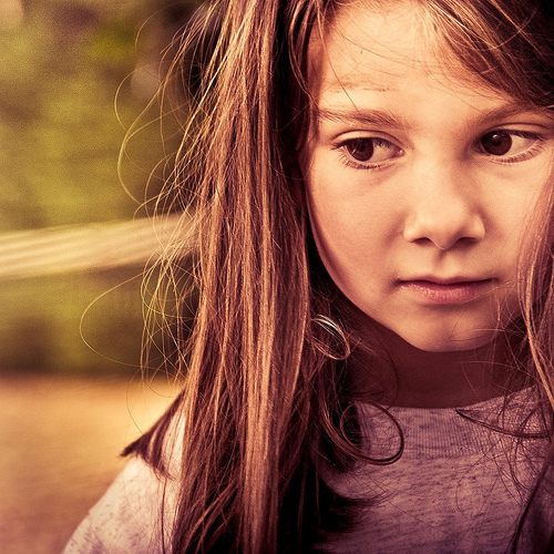 Post image for Reasons why some children need hair replacement surgery