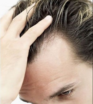 Post image for Common FAQ’s Regarding Hair Replacement