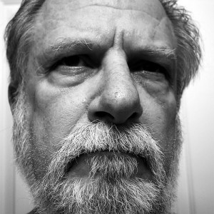 Post image for Hair Replacement Surgery After The Age Of 50