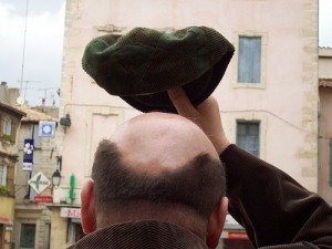 Post image for Hair Replacement To Correct Illness-Related Hair Loss