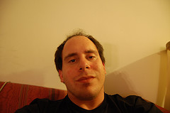 Post image for Hair replacement and some causes of hair loss