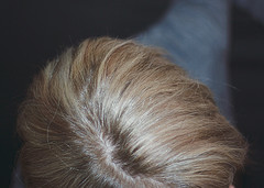 Thumbnail image for A Word of Caution About Natural Hair Replacement Remedies
